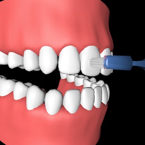 brossage dentaire Comment utiliser efficacement une brosse à dents manuelle ?