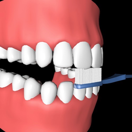 brossage dentaire Comment utiliser efficacement une brosse à dents manuelle ?