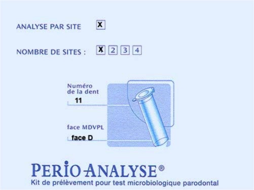 prévention dentaire test microbiologique