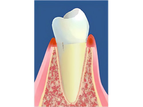 comment tiennent les dents